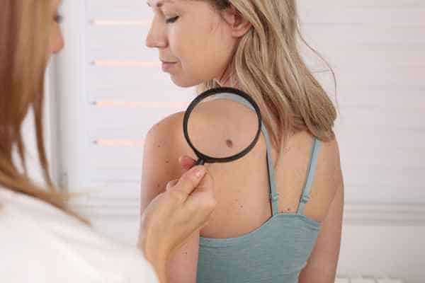 What Are Traditional Skin Lesion Removal Methods Rhyl?