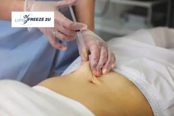 How Does Aqualyx Fat Dissolving Injection Work to Break Down Fat Rhyl?