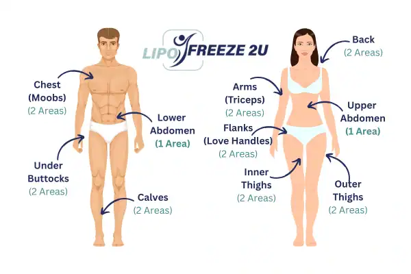 Areas you can have fat freezing treatment Rhyl
