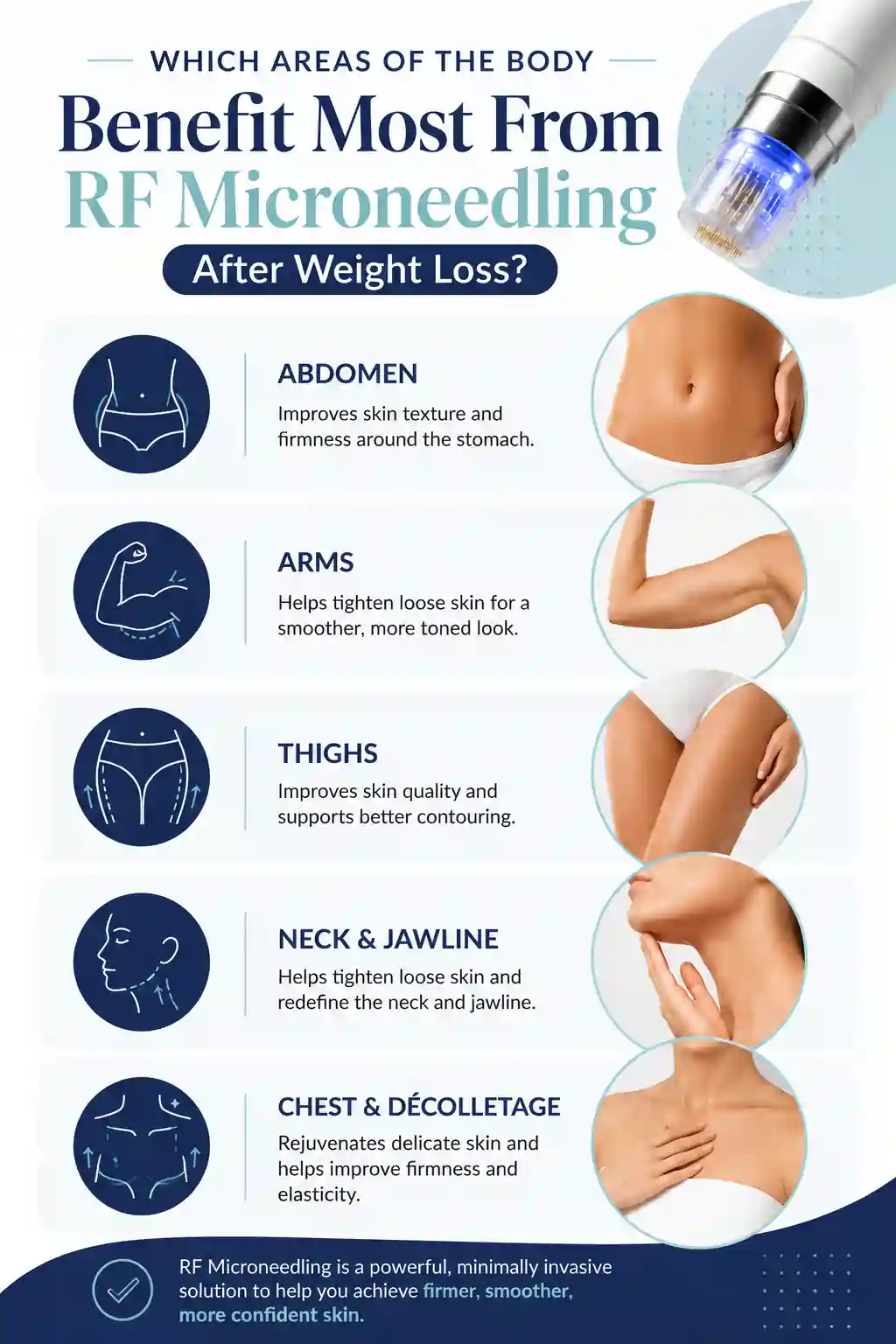 Which Areas of the Body Benefit Most From RF Microneedling After Weight Loss Rhyl